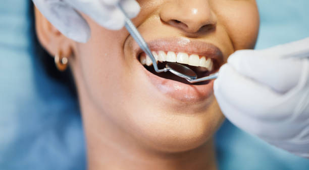 Best Dentist for Tooth Abscess  in Greensburg, IN